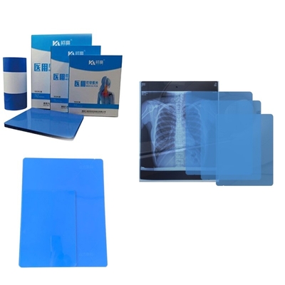 Δωρεάν δείγμα Inkjet X Ray Paper Film Imaging Εκτυπωμένο από εκτυπωτή για ακτινολογία ιατρική διάγνωση 8*10 εκτυπωτή