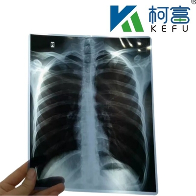 Δωρεάν δείγμα Inkjet X Ray Paper Film Imaging Εκτυπωμένο από εκτυπωτή για ακτινολογία ιατρική διάγνωση 8*10 εκτυπωτή