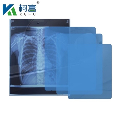 8x10 10x12 10x14 14x17 Inch Medical Dry DIHL Film Laser Xray Film Για Κλινικά και Νοσοκομεία