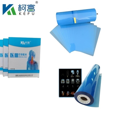Υψηλής αντίθεσης Laser Film Inkjet Medical Film Blue PET X-Ray Film για Inkjet και Laser εκτυπωτές