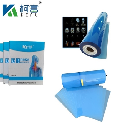 CT Scanner ξηρό ακτινογραφικό A3 / A4 Ιατρικό μελάνι Jet Blue Film X-ray PET Film