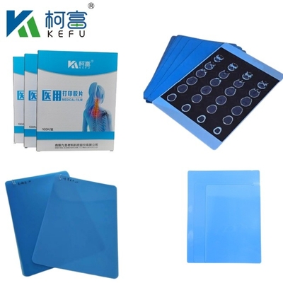 CT Scanner ξηρό ακτινογραφικό A3 / A4 Ιατρικό μελάνι Jet Blue Film X-ray PET Film