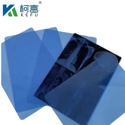 CT Scanner ξηρό ακτινογραφικό A3 / A4 Ιατρικό μελάνι Jet Blue Film X-ray PET Film