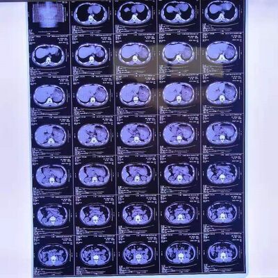 Λογικό κόστος Ιατρικές ταινίες ακτινογραφίας με υψηλή σταθερότητα εικόνας που παρέχουν σαφείς και ακριβείς ιατρικές διαγνωστικές εικόνες