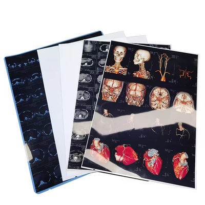 Υψηλής ανάλυσης Γαλάζια λευκή ιατρική ταινία ακτινογραφίας με γυαλιστερό φινίρισμα επιφάνειας