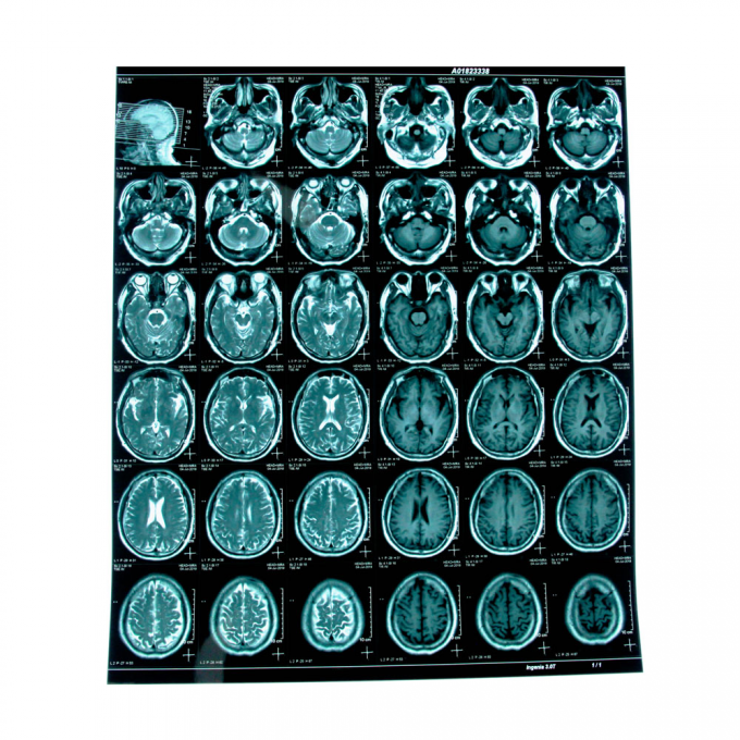 &Mu;&pi;&lambda;&epsilon; &mu;&epsilon;&lambda;ά&nu;&iota; &iota;&alpha;&tau;&rho;&iota;&kappa;ή&sigmaf; &alpha;&kappa;&tau;&iota;&nu;&omicron;&beta;&omicron;&lambda;ί&alpha;&sigmaf; &Phi;ό&rho;&mu;&alpha; &iota;&alpha;&tau;&rho;&iota;&kappa;ή&sigmaf; &xi;&eta;&rho;ή&sigmaf; &tau;&alpha;&iota;&nu;ί&alpha;&sigmaf; &Alpha;4 &Alpha;3 &sigma;&epsilon; &phi;ύ&lambda;&lambda;&alpha; ή &sigma;&epsilon; &rho;ό&lambda;&omicron;&upsilon;&sigmaf; 0