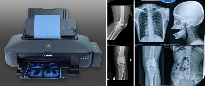 Προχωρημένη γαλάζια ιατρική ταινία ακτινογραφίας για καθαρή και ακριβή απεικόνιση 3
