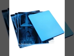 14*17 ίντσα 35x43cm ιατρική ξηρά ταινία διαφάνειας Inkjet ταινιών του Φούτζι για την εκτύπωση οθόνης